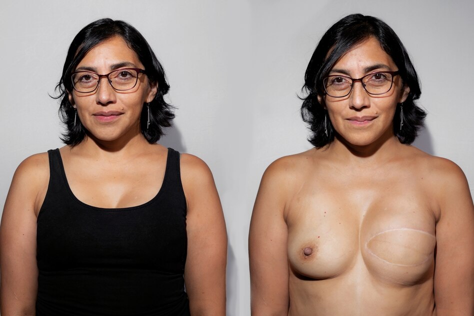 Fotoprojekt über Krebserkrankte: „Es geht nicht nur um die Narben“